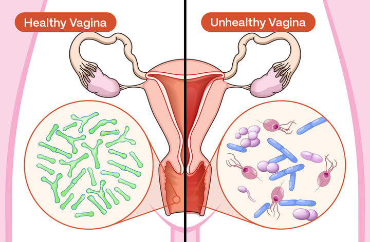 System Breakdown 2:<br><b>Your microbiome gets disrupted</b>