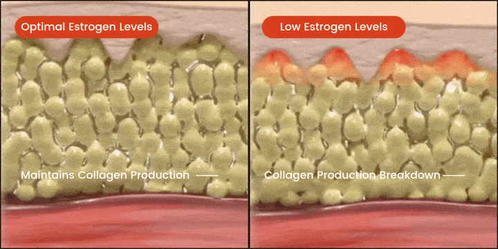 Low Collagen Production