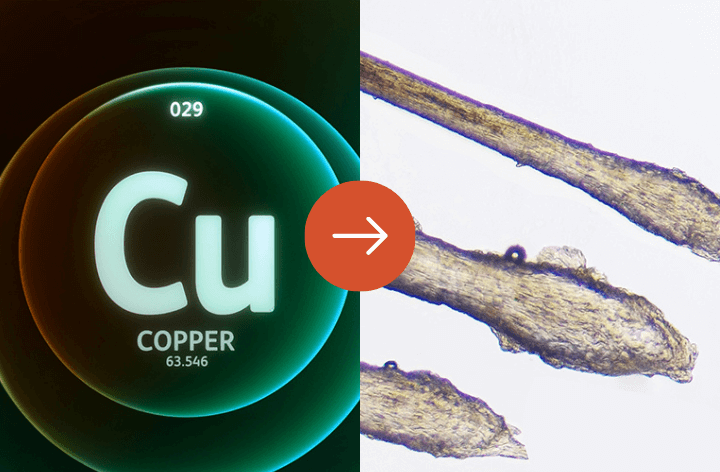 <b>TRIGGER #6: Copper Deficiency</b><br>System Breakdown: Low lysyl oxidase enzyme weakens follicle anchoring